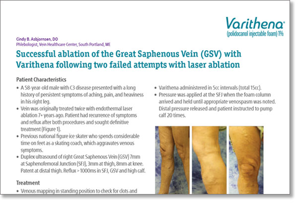 Case study first page with title and images of different veins in legs